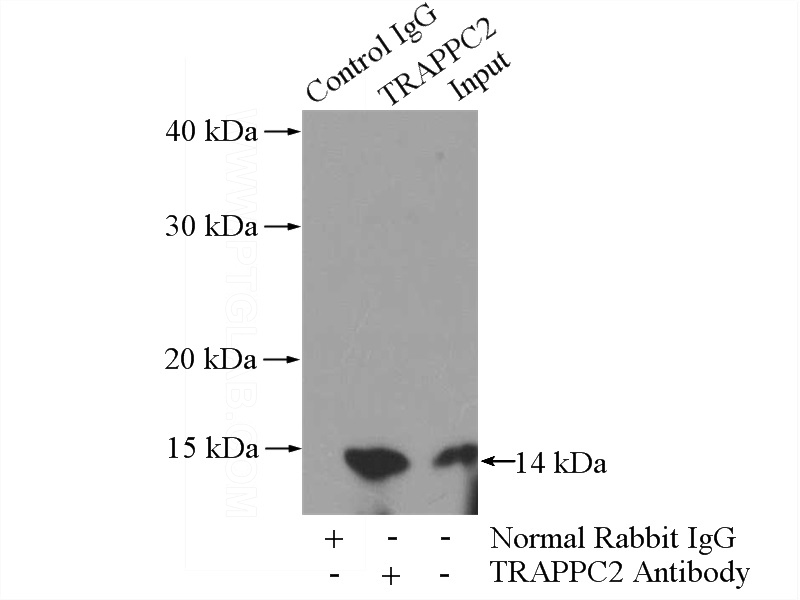 IP Result of anti-TRAPPC2 (IP:Catalog No:116342, 3ug; Detection:Catalog No:116342 1:500) with PC-3 cells lysate 2800ug.