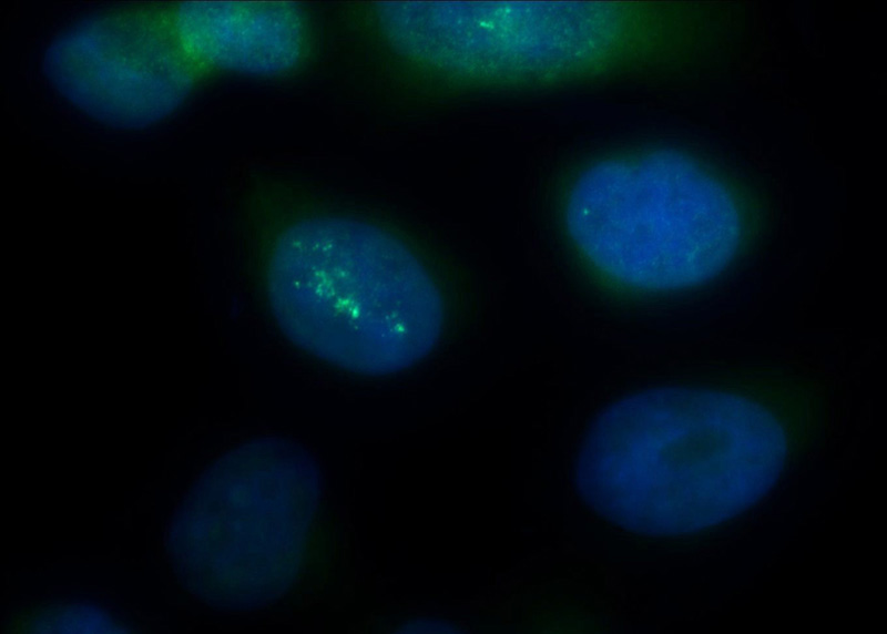 Immunofluorescent analysis of HepG2 cells using Catalog No:114373(PSMA2 Antibody) at dilution of 1:50 and Alexa Fluor 488-congugated AffiniPure Goat Anti-Rabbit IgG(H+L)