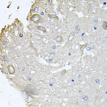 Immunohistochemistry - CHCHD3 Polyclonal Antibody 