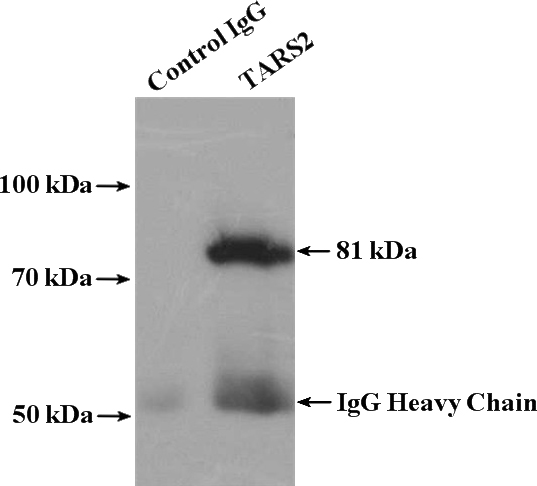 IP Result of anti-TARS2 (IP:Catalog No:115854, 4ug; Detection:Catalog No:115854 1:600) with mouse liver tissue lysate 4000ug.