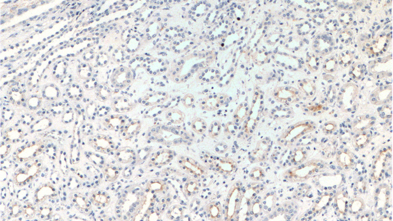 Immunohistochemistry of paraffin-embedded human kidney tissue slide using Catalog No:113195(SLC12A1 Antibody) at dilution of 1:200 (under 10x lens).