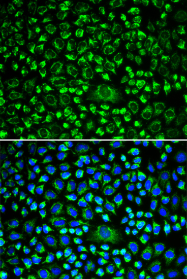 Immunofluorescence - TAPBP Polyclonal Antibody 