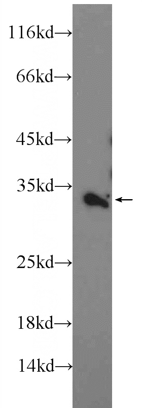 HeLa cells were subjected to SDS PAGE followed by western blot with Catalog No:116767(VNN2 Antibody) at dilution of 1:600