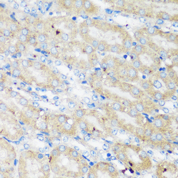 Immunohistochemistry - ELP3 Polyclonal Antibody 