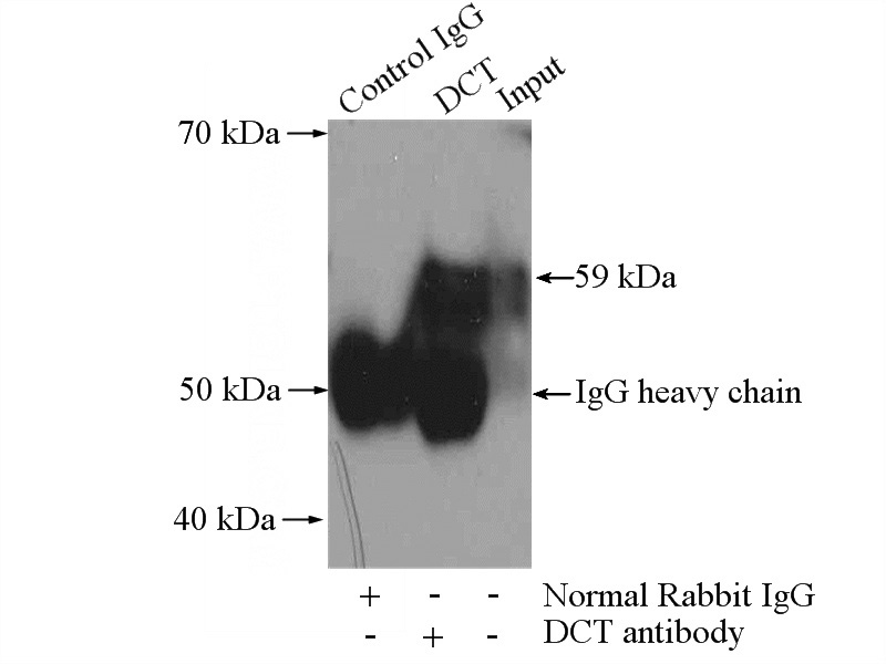 IP Result of anti-DCT (IP:Catalog No:109757, 4ug; Detection:Catalog No:109757 1:500) with HL-60 cells lysate 4000ug.