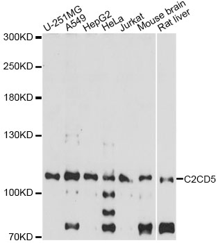 Western blot - C2CD5 Polyclonal Antibody 