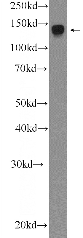SH-SY5Y cells were subjected to SDS PAGE followed by western blot with Catalog No:108840(CAPRIN2 Antibody) at dilution of 1:300