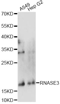 Western blot - RNASE3 Polyclonal Antibody 