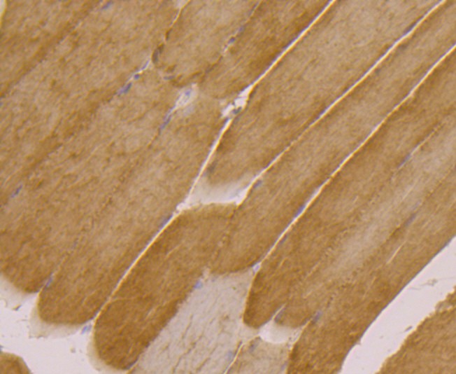 Fig2: Immunohistochemical analysis of paraffin-embedded rat skeletal muscle tissue using anti-UGP2 antibody. Counter stained with hematoxylin.