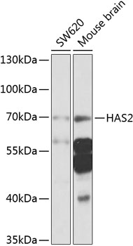 Western blot - HAS2 Polyclonal Antibody 