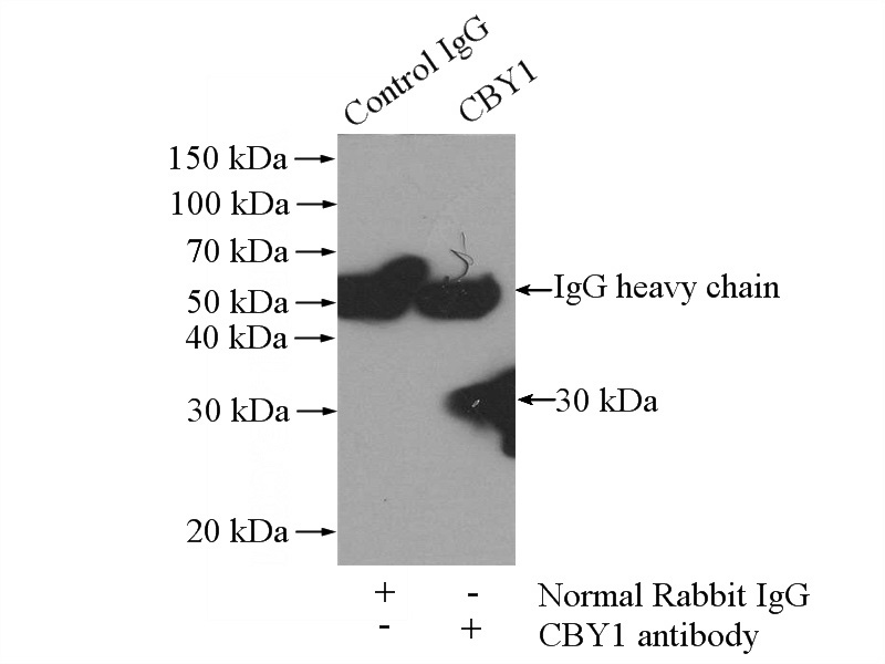 IP Result of anti-CBY1 (IP:Catalog No:108950, 4ug; Detection:Catalog No:108950 1:500) with mouse liver tissue lysate 4000ug.