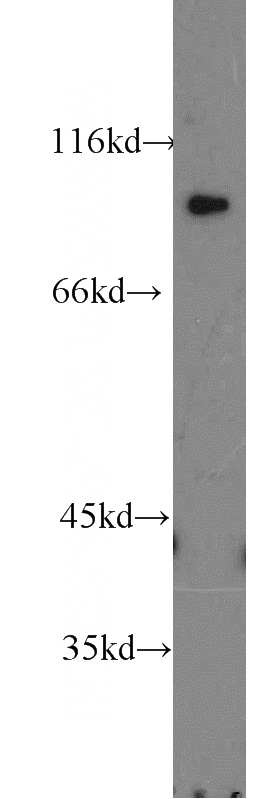 HEK-293 cells were subjected to SDS PAGE followed by western blot with Catalog No:108342(ATP1A2 antibody) at dilution of 1:1200