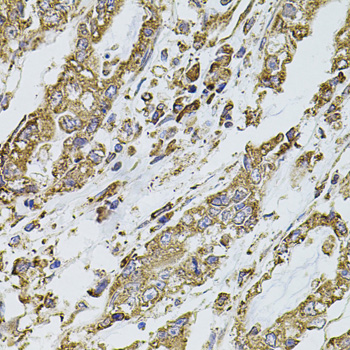 Immunohistochemistry - PIK3CA Polyclonal Antibody 