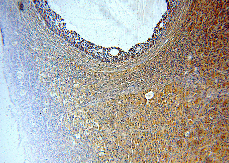 Immunohistochemical of paraffin-embedded human ovary using Catalog No:108543(BTG4 antibody) at dilution of 1:50 (under 10x lens)
