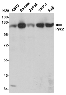 Western blot detection of Pyk2 in A549,Ramos,Jurkat,THP-1 and Raji cell lysates using Pyk2 mouse mAb (1:1000 diluted).Predicted band size:116KDa.Observed band size:116KDa.