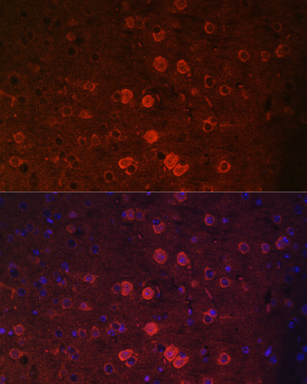 Immunofluorescence - TRPM2 Polyclonal Antibody 