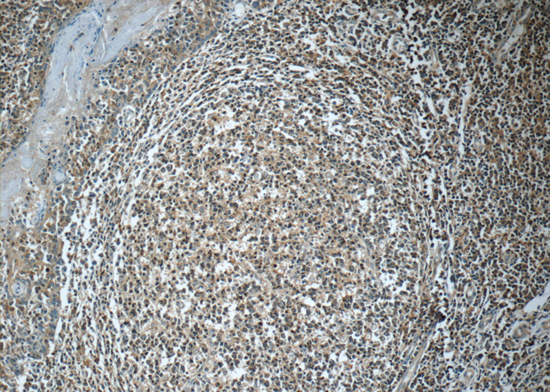 Immunohistochemistry of paraffin-embedded human tonsillitis tissue slide using Catalog No:110988(GNAI2 Antibody) at dilution of 1:50 (under 10x lens)