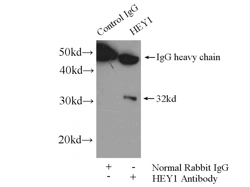IP Result of anti-HEY1 (IP:Catalog No:111308, 4ug; Detection:Catalog No:111308 1:500) with mouse kidney tissue lysate 4400ug.