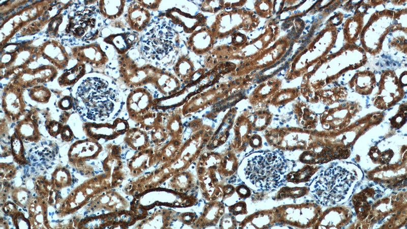 Immunohistochemical of paraffin-embedded human kidney using Catalog No:113412(NUDCD2 antibody) at dilution of 1:100 (under 10x lens)