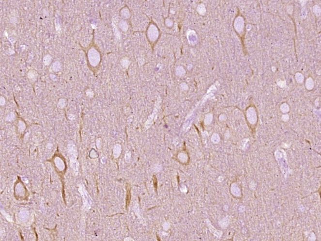 Fig2: Paraformaldehyde-fixed, paraffin embedded (Rat brain); Antigen retrieval by boiling in sodium citrate buffer (pH6.0) for 15min; Block endogenous peroxidase by 3% hydrogen peroxide for 20 minutes; Blocking buffer (normal goat serum) at 37℃ for 30min; Antibody incubation with (beta I Tubulin) Monoclonal Antibody, Unconjugated at 1:400 overnight at 4℃, followed by operating according to SP Kit(Mouse) (sp-0024) instructions and DAB staining.