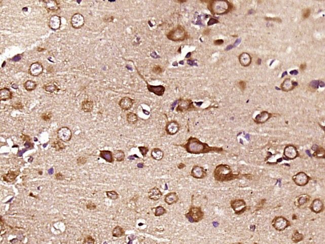 Fig2: Paraformaldehyde-fixed, paraffin embedded (rat brain tissue); Antigen retrieval by boiling in sodium citrate buffer (pH6.0) for 15min; Block endogenous peroxidase by 3% hydrogen peroxide for 20 minutes; Blocking buffer (normal goat serum) at 37℃ for 30min; Antibody incubation with (KLHL18) Polyclonal Antibody, Unconjugated at 1:400 overnight at 4℃, followed by operating according to SP Kit(Rabbit) (sp-0023) instructionsand DAB staining.