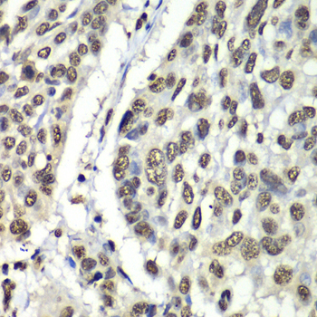 Immunohistochemistry - HNRNPM Polyclonal Antibody 