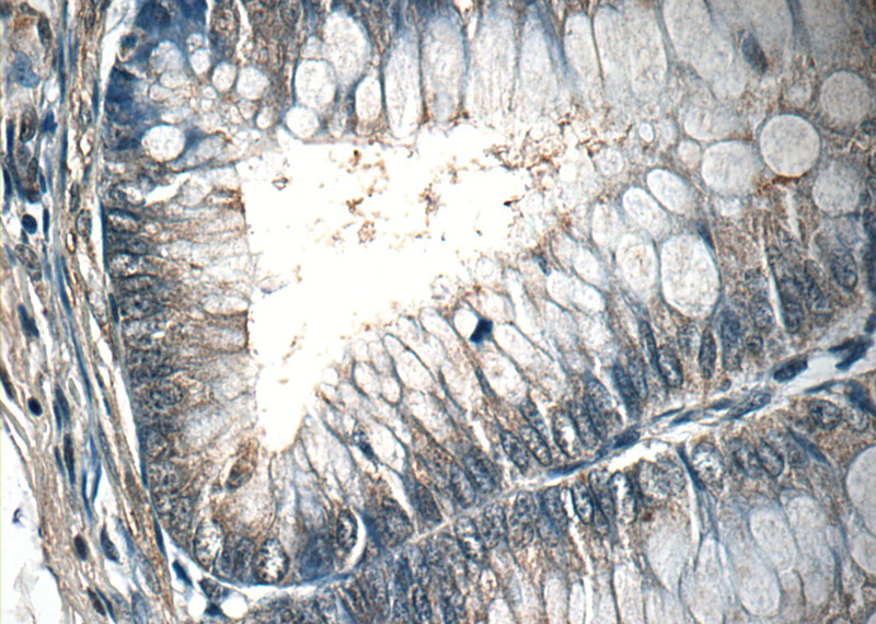 Immunohistochemistry of paraffin-embedded human colon tissue slide using Catalog No:107719(ACADL-Specific Antibody) at dilution of 1:50 (under 40x lens)