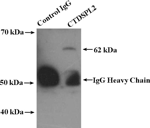 IP Result of anti-CTDSPL2 (IP:Catalog No:109722, 4ug; Detection:Catalog No:109722 1:500) with mouse testis tissue lysate 4400ug.