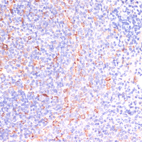 Immunohistochemistry - IKBKE Polyclonal Antibody 