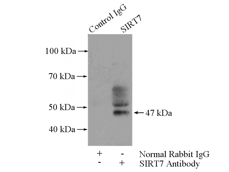 IP Result of anti-SIRT7 (IP:Catalog No:115248, 4ug; Detection:Catalog No:115248 1:300) with mouse liver tissue lysate 4000ug.
