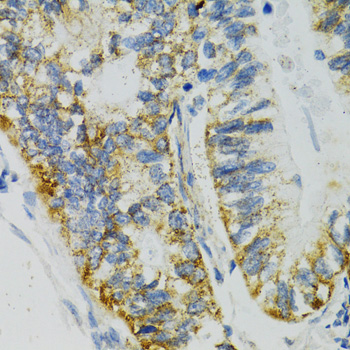 Immunohistochemistry - SLC27A2 Polyclonal Antibody 