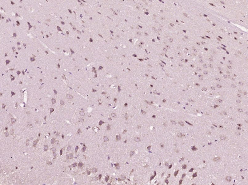 Fig1: Paraformaldehyde-fixed, paraffin embedded (Mouse brain); Antigen retrieval by boiling in sodium citrate buffer (pH6.0) for 15min; Block endogenous peroxidase by 3% hydrogen peroxide for 20 minutes; Blocking buffer (normal goat serum) at 37℃ for 30min; Antibody incubation with (Styk1) Polyclonal Antibody, Unconjugated at 1:400 overnight at 4℃, followed by operating according to SP Kit(Rabbit) (sp-0023) instructionsand DAB staining.