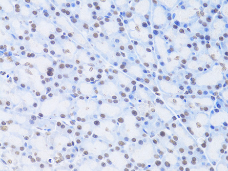 Immunohistochemistry - LMNB2 Polyclonal Antibody 