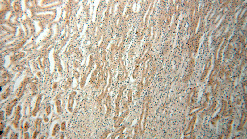 Immunohistochemical of paraffin-embedded human kidney using Catalog No:110298(EDAR antibody) at dilution of 1:100 (under 10x lens)