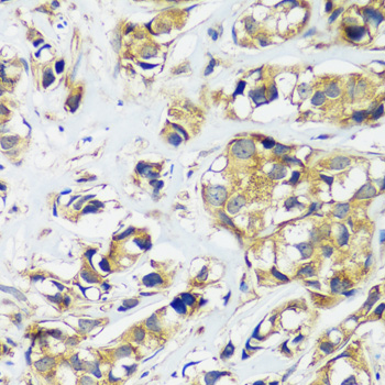 Immunohistochemistry - CCDC124 Polyclonal Antibody 