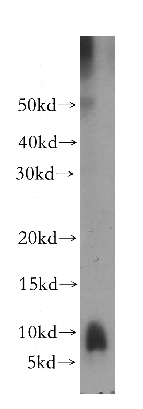 mouse liver tissue were subjected to SDS PAGE followed by western blot with Catalog No:114087(PPBP antibody) at dilution of 1:300