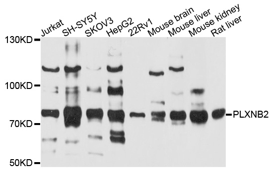 Western blot - PLXNB2 Polyclonal Antibody 