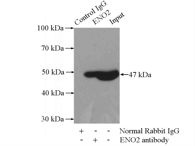 IP Result of anti-ENO2 (IP:Catalog No:113288, 4ug; Detection:Catalog No:113288 1:300) with mouse brain tissue lysate 4000ug.