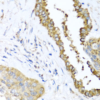 Immunohistochemistry - DFNA5 Polyclonal Antibody 
