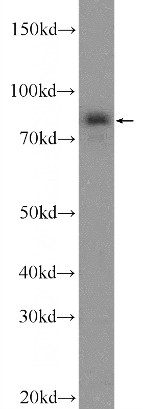 HeLa cells were subjected to SDS PAGE followed by western blot with Catalog No:113577(PAPOLG Antibody) at dilution of 1:1000