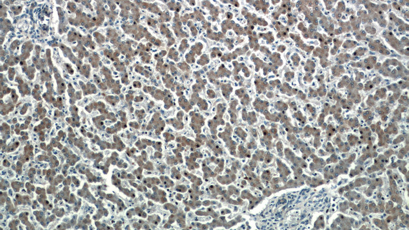Immunohistochemistry of paraffin-embedded human liver tissue slide using Catalog No:111291(HEPACAM Antibody) at dilution of 1:50 (under 10x lens)