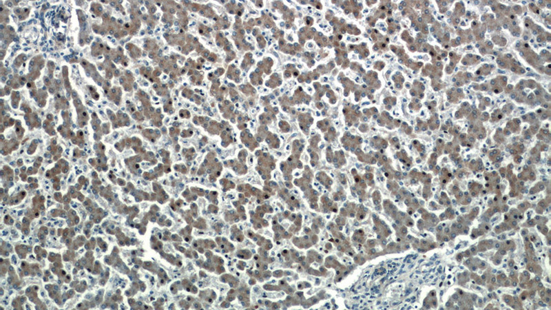 Immunohistochemistry of paraffin-embedded human liver tissue slide using Catalog No:111291(HEPACAM Antibody) at dilution of 1:50 (under 10x lens)