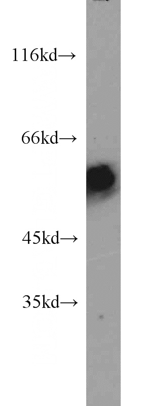 human brain tissue were subjected to SDS PAGE followed by western blot with Catalog No:107271(PTPRN antibody) at dilution of 1:500