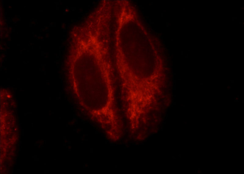 Immunofluorescent analysis of HepG2 cells using Catalog No:113050(ND1 Antibody) at dilution of 1:25 and Rhodamine-Goat anti-Rabbit IgG