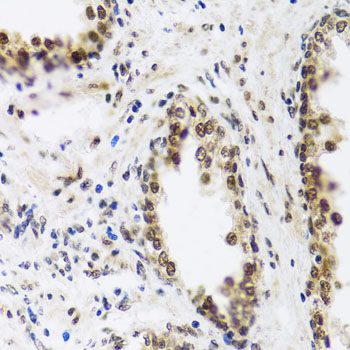 Immunohistochemistry - SAFB2 Polyclonal Antibody 