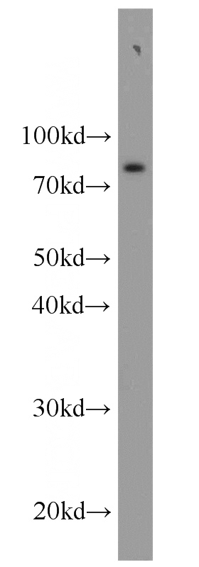 mouse spleen tissue were subjected to SDS PAGE followed by western blot with Catalog No:111749(IL6R antibody) at dilution of 1:1000