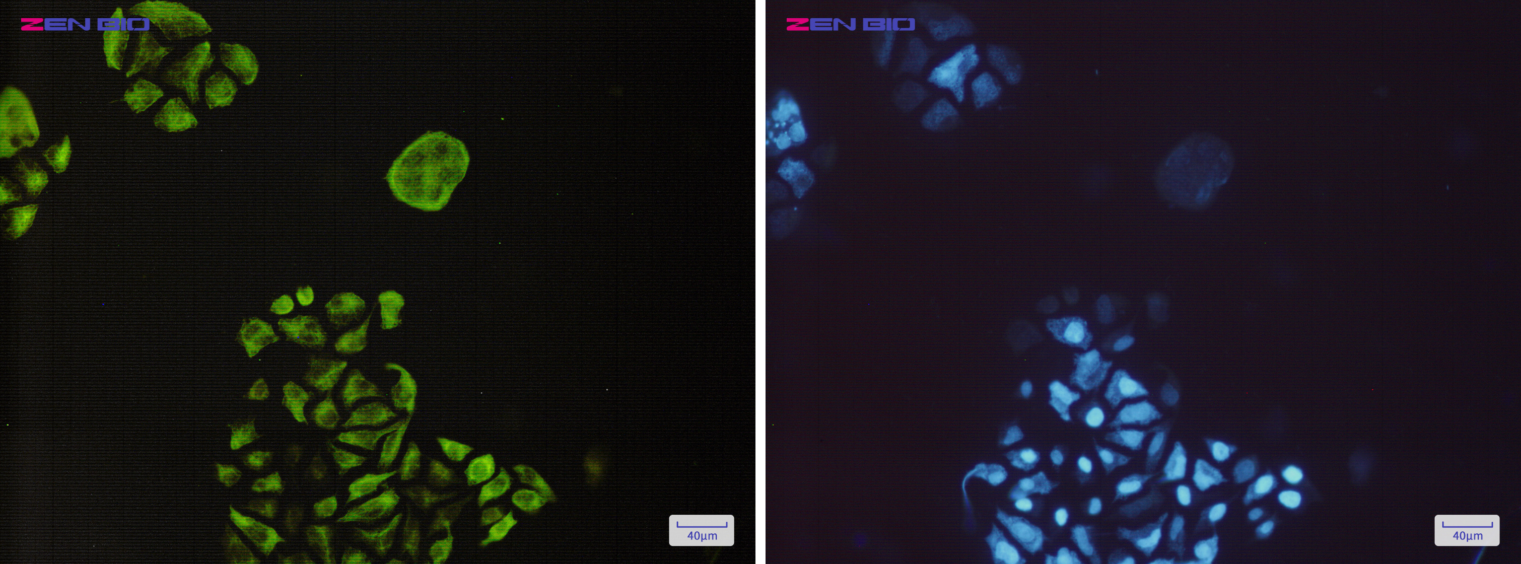 Immunocytochemistry of Phospho-GSK3 beta (Ser9)(green) in Hela cells using Phospho-GSK3 beta (Ser9) Rabbit mAb at dilution 1/50, and DAPI(blue)