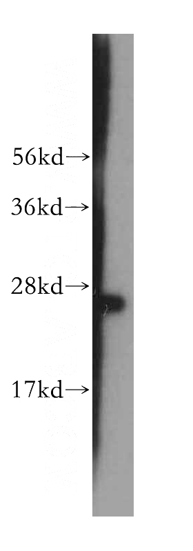 human brain tissue were subjected to SDS PAGE followed by western blot with Catalog No:108268(ASPH antibody) at dilution of 1:500