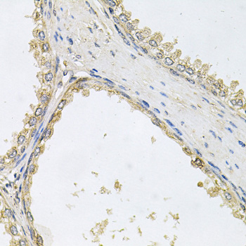 Immunohistochemistry - POMGNT1 Polyclonal Antibody 