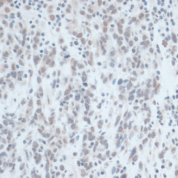 Immunohistochemistry - ZNF703 Polyclonal Antibody 